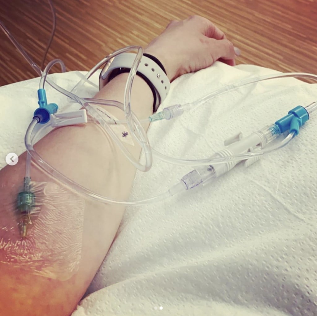 an arm hooked up to intravenous therapy for infusion
